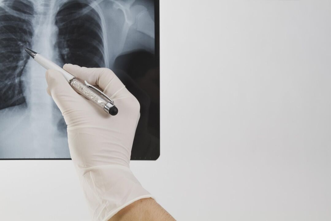 X-ray fun ṣiṣe ayẹwo osteochondrosis