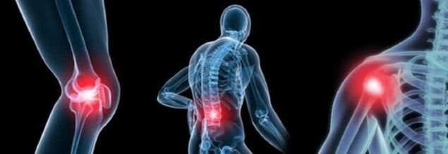 Awọn oriṣi irora pẹlu arthrosis