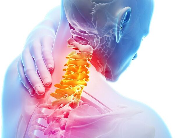 Awọn aami aisan ati awọn ipele ti idagbasoke ti osteochondrosis