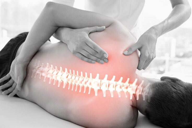 Igba itọju afọwọṣe fun osteochondrosis ti ọpa ẹhin thoracic